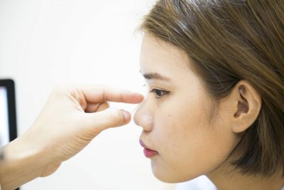 xem tướng mũi gãy