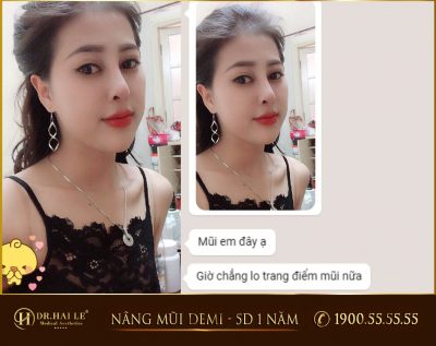 Có nên nâng mũi ở Dr.Hải Lê không 2