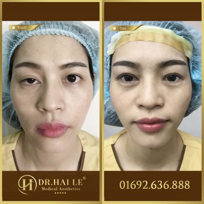 Những lợi ích của phẫu thuật thẩm mỹ 2