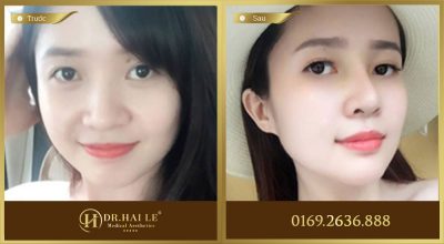 Phẫu thuật thẩm mỹ là gì 2