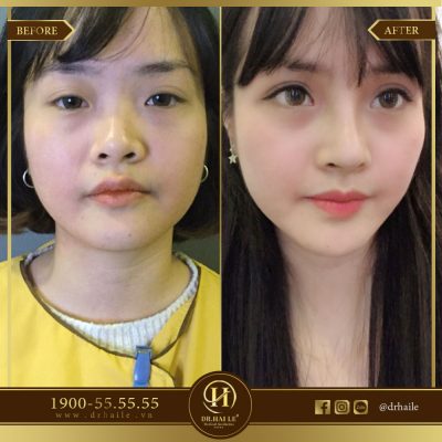 xem ngày tốt phẫu thuật thẩm mỹ 2