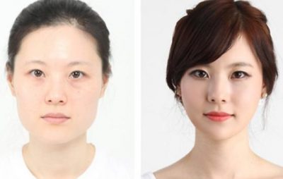Phẫu thuật thẩm mỹ là gì