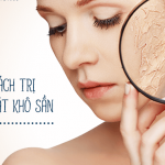 Cách làm dịu da mặt bị khô sần và ngứa