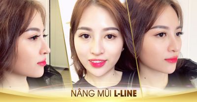 nang mui tai thai lan giá bao nhiêu
