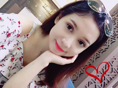 Kết quả sau khi cắt mí Mini Deep 5D tại Dr.Hải Lê