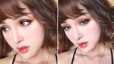 Ưu điểm khi nâng mũi, cắt mí tại Dr.Hải Lê